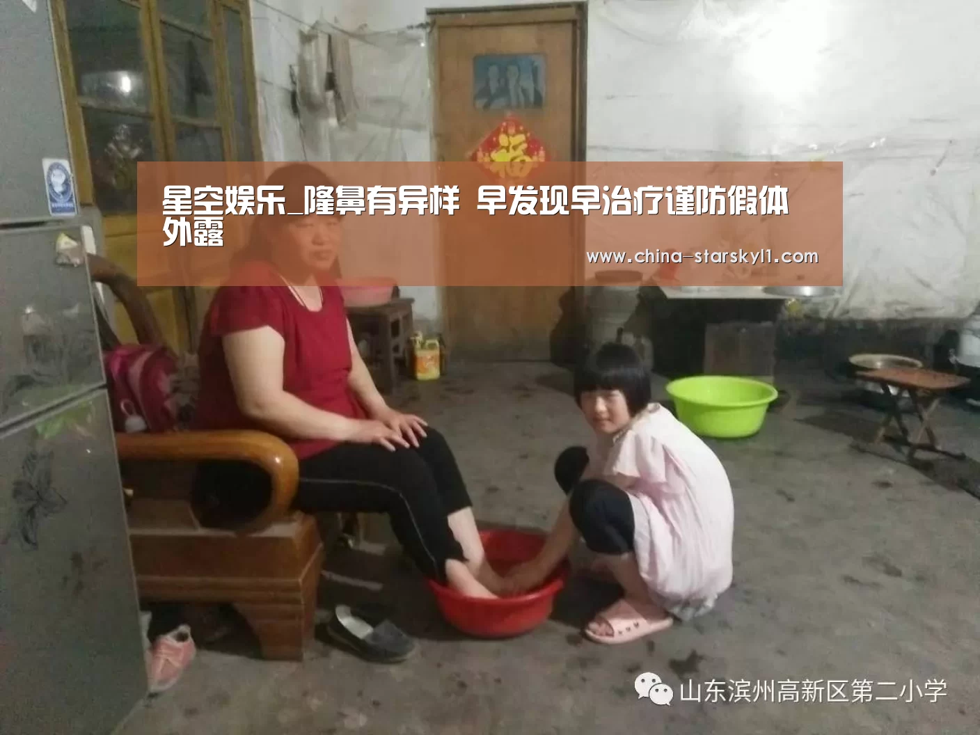 星空娱乐_隆鼻有异样 早发现早治疗谨防假体外露