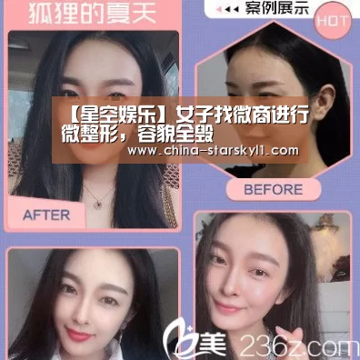 【星空娱乐】女子找微商进行微整形,容貌全毁(图1) 星空娱乐